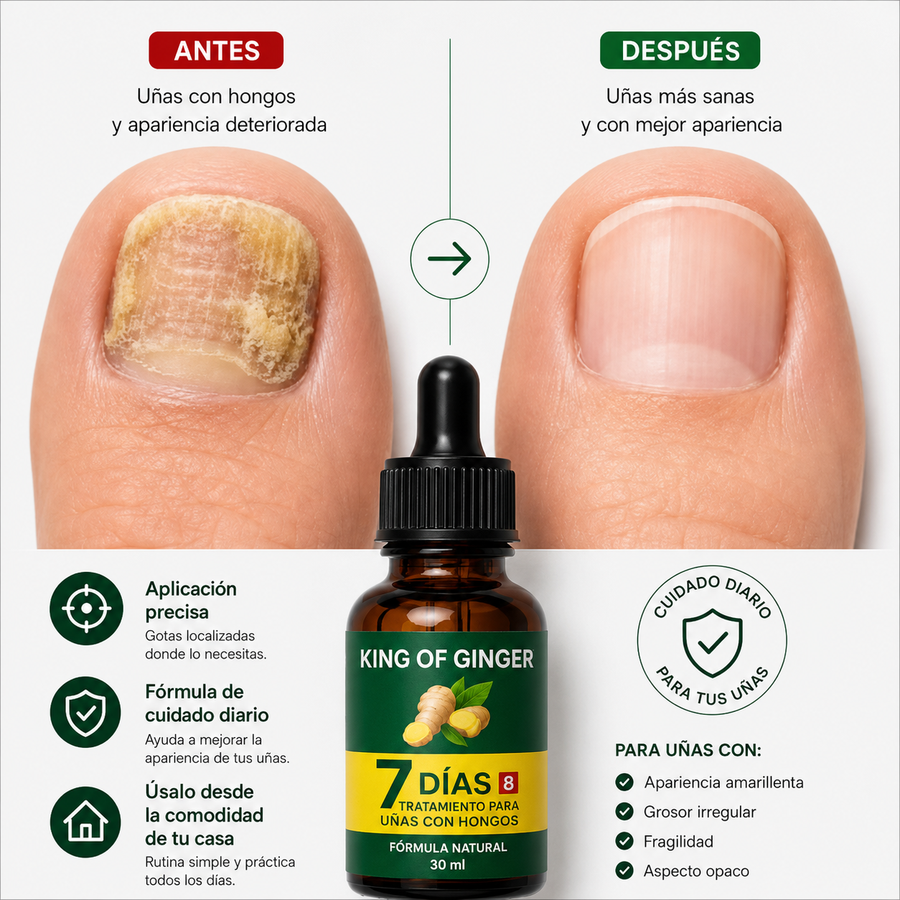 Elimina el Hongo de tus Uñas en 7 Días + Envío Gratis — comparación