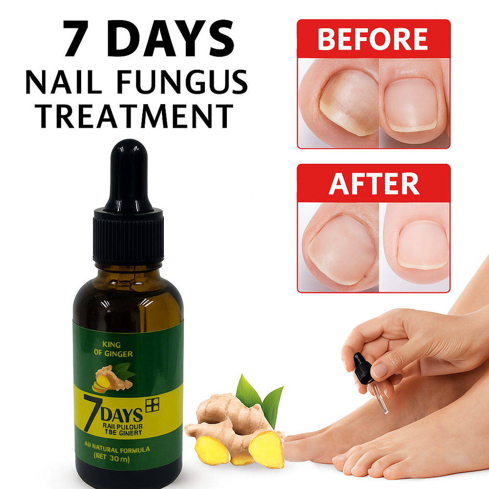Elimina el Hongo de tus Uñas en 7 Días + Envío Gratis