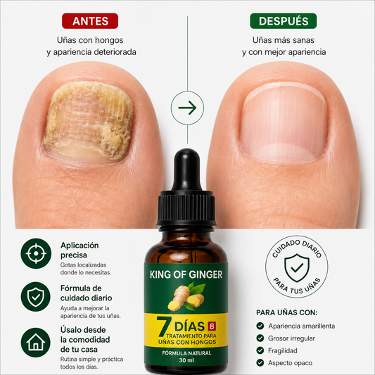 Elimina el Hongo de tus Uñas en 7 Días + Envío Gratis